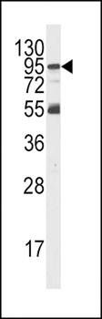 PI3KR5 antibody