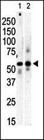 PI 4 Kinase type 2 beta antibody