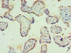 PIAS1 Antibody
