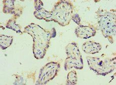 PIAS1 antibody