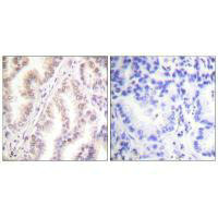 PIAS1 Antibody