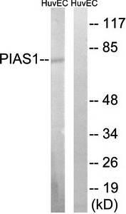 PIAS1 Antibody