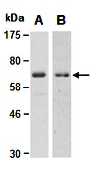PIAS1 antibody