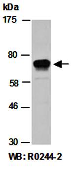 PIAS1 antibody