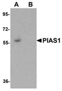 PIAS1 Antibody