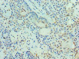 PIAS3 Antibody