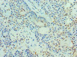 PIAS3 antibody