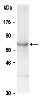 PIAS3 (C) Antibody, Rabbit Polyclonal