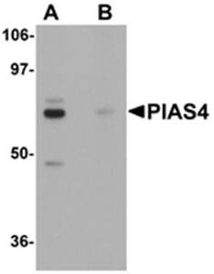PIAS4 Antibody