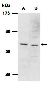 PIASy (C1a) Antibody, Rabbit Polyclonal