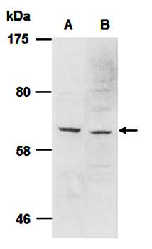 PIASy antibody