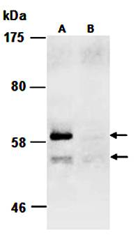 PIASy (C1b) Antibody, Rabbit Polyclonal