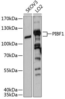 PIBF1 antibody