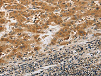 PIBF1 Antibody
