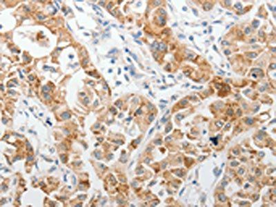 PIBF1 Antibody