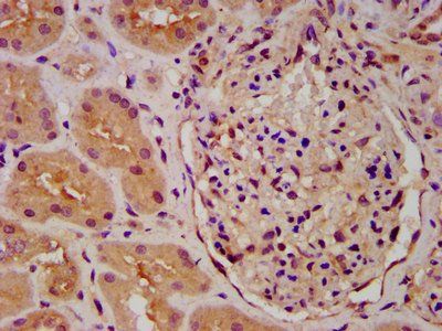 PICALM Antibody