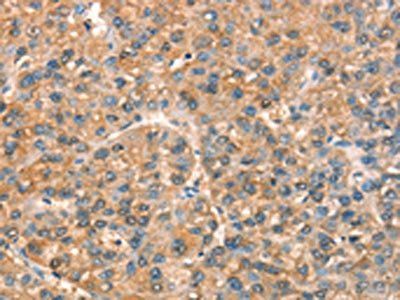 PICK1 Antibody