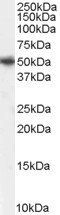 Goat anti-PICK1 Antibody