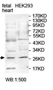 PID1 Rabbit Polyclonal Antibody