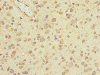 PIEZO1 Antibody