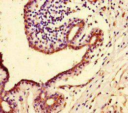 PIF1 Antibody