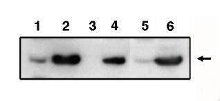 Rabbit anti Human PIG3 (p53 inducible gene 3)