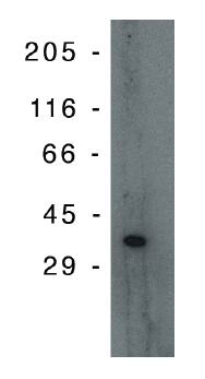Mouse anti Human PIG3 (p53 inducible gene 3)