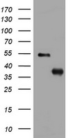 PIG3 (TP53I3) antibody