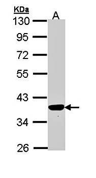 PIG3 antibody