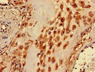 PIGA Antibody