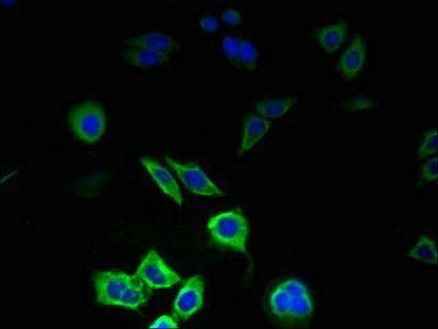 PIGC Antibody