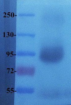 PIGR antibody