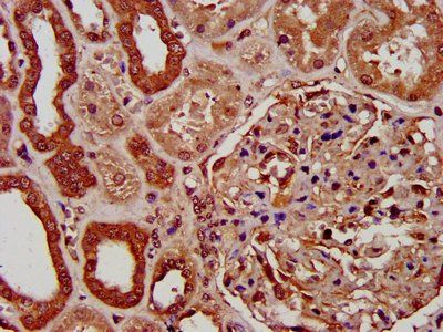 PIGV Antibody