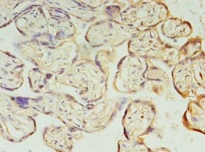 PIH1D1 Antibody