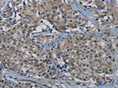 PIK3CG antibody