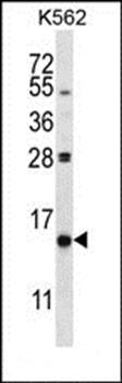PIK3IP1 antibody