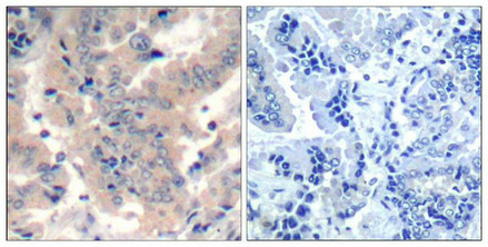 PIK3R1/PIK3R3 (Ab-467/199) Antibody