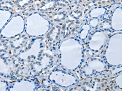 PIK3R2 Antibody