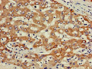 PIK3R2 Antibody