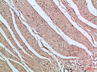 PIK3R2 antibody