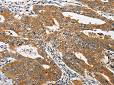 PIK3R3 Antibody