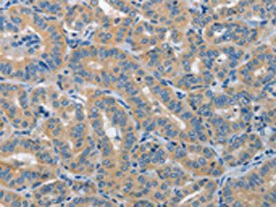 PIK3R4 Antibody