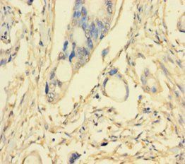 PIK3R5 Antibody