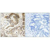 PIK3R5 Antibody