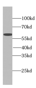 Pikachurin antibody