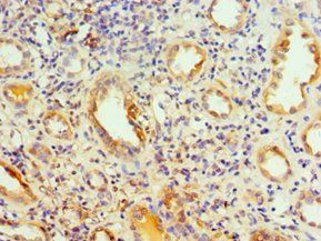 PIKFYVE Antibody