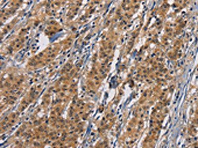 PIKFYVE Antibody