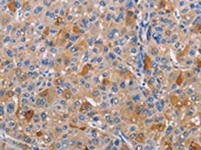 PIKFYVE Antibody