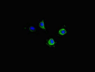 PIM2 Antibody