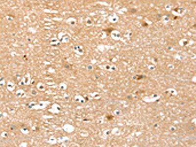 PIN1 Antibody